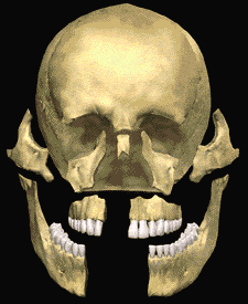 animated skull showing facial trauma and injuries and the reconstruction process